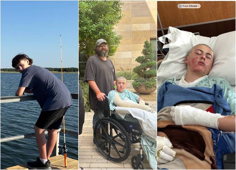 UBO8-快讯新闻-💥玩命挑戰！美國12歲童模仿TikTok「酒精實驗」，全身瞬間成火球🔥